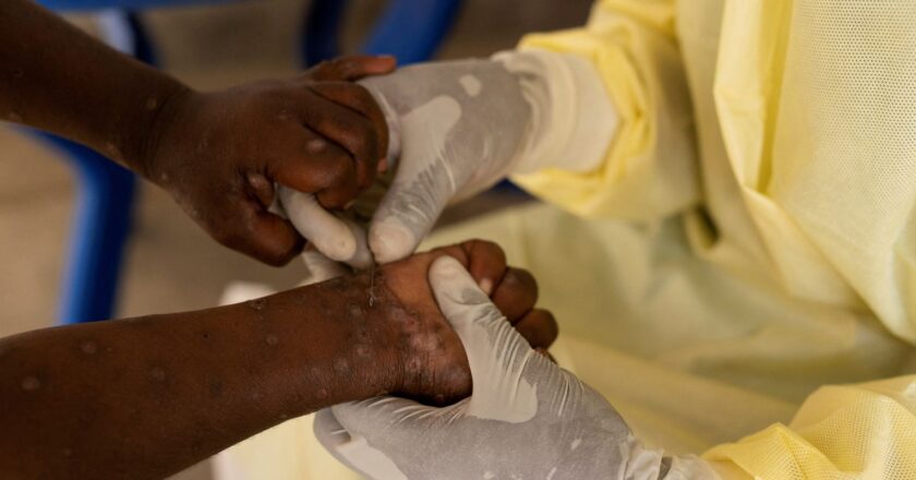 Mpox: saiba quais doenças já tiveram mais alto nível de alerta global