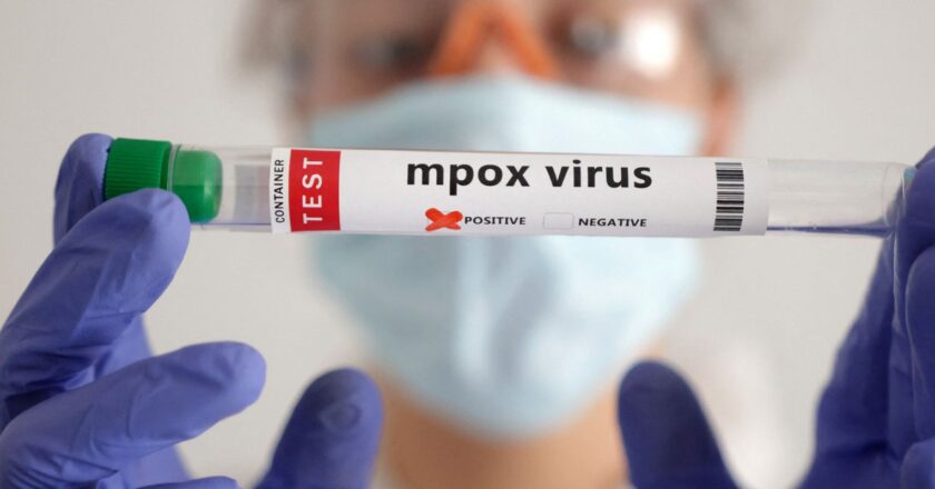 OMS estima custo de US$ 135 milhões em 6 meses para conter mpox