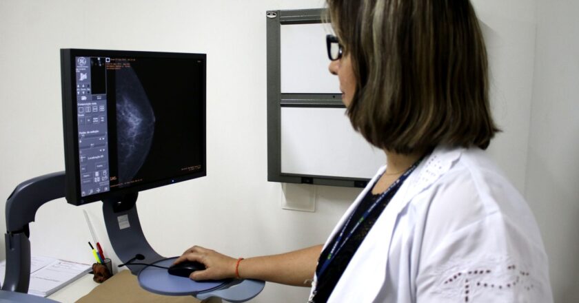 Pesquisa mostra desconhecimento sobre prevenção do câncer de mama