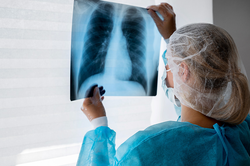 Médica oservando radiografia pulmonar