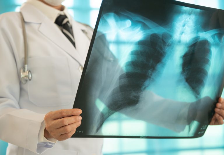 Médico examina raio X de pulmão