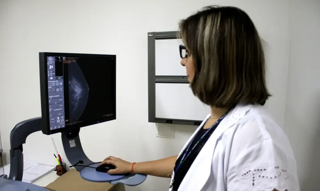 Ministério da Saúde padroniza informações para acesso ao exame de mamografia no SUS