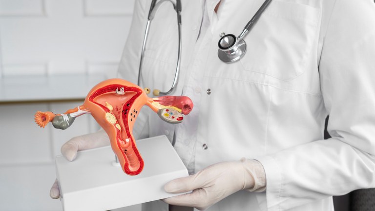 União amplia atendimento do SUS a mulheres com endometriose profunda