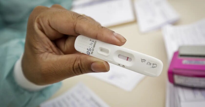 Positividade de testes de covid-19 subiu de 4% para 13%, diz UFRJ