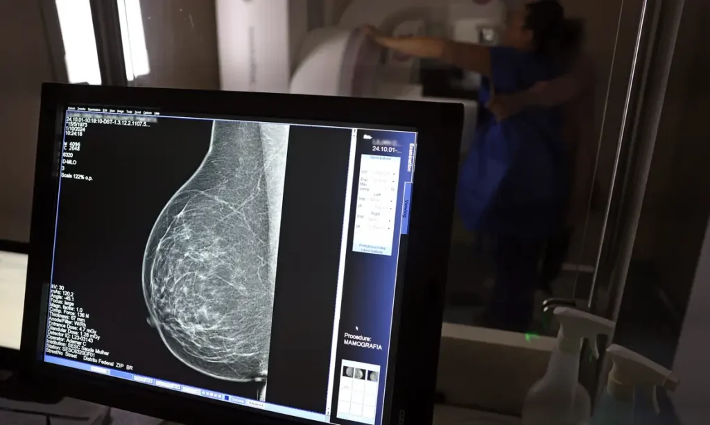 Outubro Rosa: diagnóstico precoce ganha reforço com mamografia a partir dos 40 anos