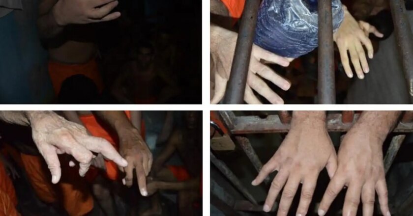 Técnica de tortura de fraturar dedo de presos é usada em cinco estados