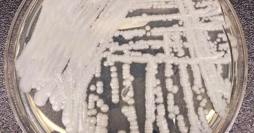 Fiocruz e Pasteur vão pesquisar sobre danos dos fungos no ser humano