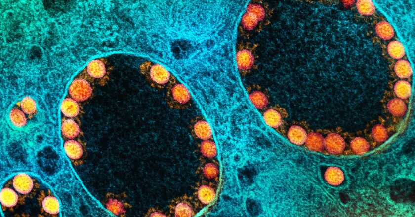 Fim da emergência de saúde pública foi acertado, avaliam especialistas